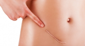 Tratamiento de fisioterapia estética en postoperatorios de cirugía estética, plástica y reparadora