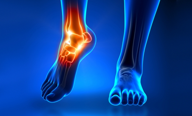 Curso Avanzado Electrolisis Percutánea Musculoesquelética Ecoguiada. Casos Clínicos. Cuadrante Inferior
