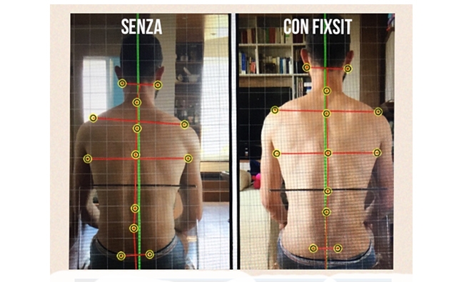 CURSO GRATUITO: Disfunciones posturales en sedestación con el sistema FixSit®