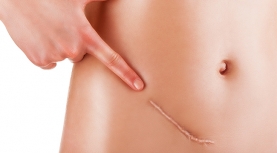 Tratamiento de fisioterapia estética en postoperatorios de cirugía estética, plástica y reparadora