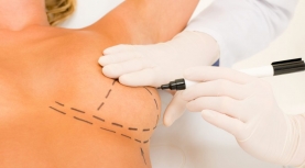 Tratamiento de fisioterapia en cirugía de mama