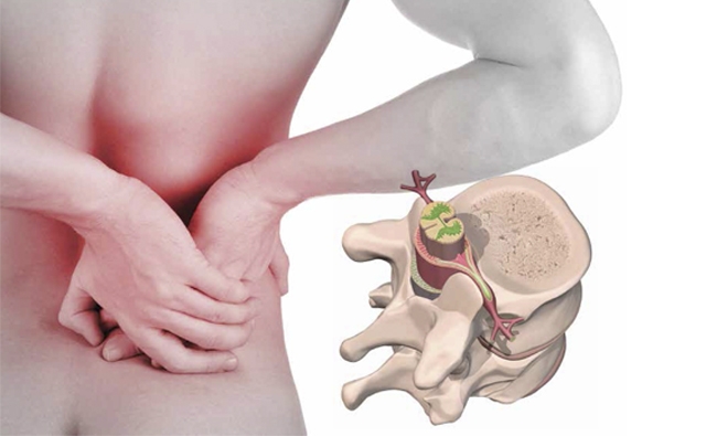 Jornada De Fisioterapia: Terapia Manual De La Columna Vertebral