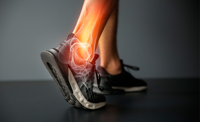 Abordaje activo en las lesiones del pie y tobillo en el deporte