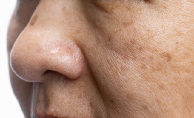 Noviembre 2025: Fisioterapia Dermatofuncional Facial con técnicas fotosensibles