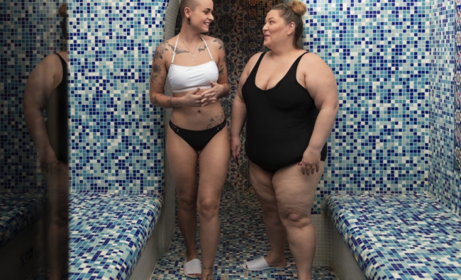 Abordaje del Lipedema desde la Fisioterapia Dermatofuncional