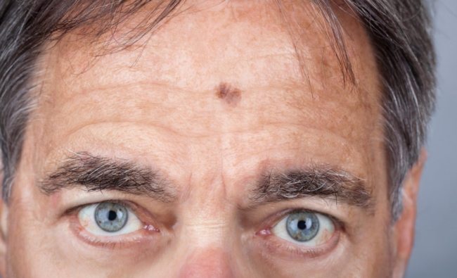 Noviembre 2025: Fisioterapia Dermatofuncional Facial con técnicas fotosensibles