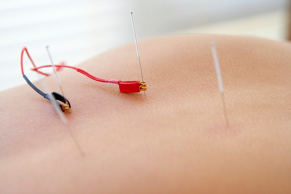 electroacupuncture Instema, Formación para fisioterapeutas
