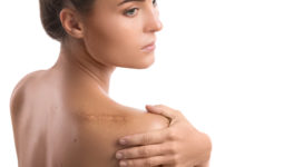 Woman with a scar on her shoulder over white background